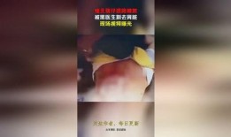 缅北 医生爆料视频大全,真实视频大全背后的惊人真相